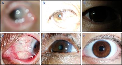 DeepMonitoring: a deep learning-based monitoring system for assessing the quality of cornea images captured by smartphones